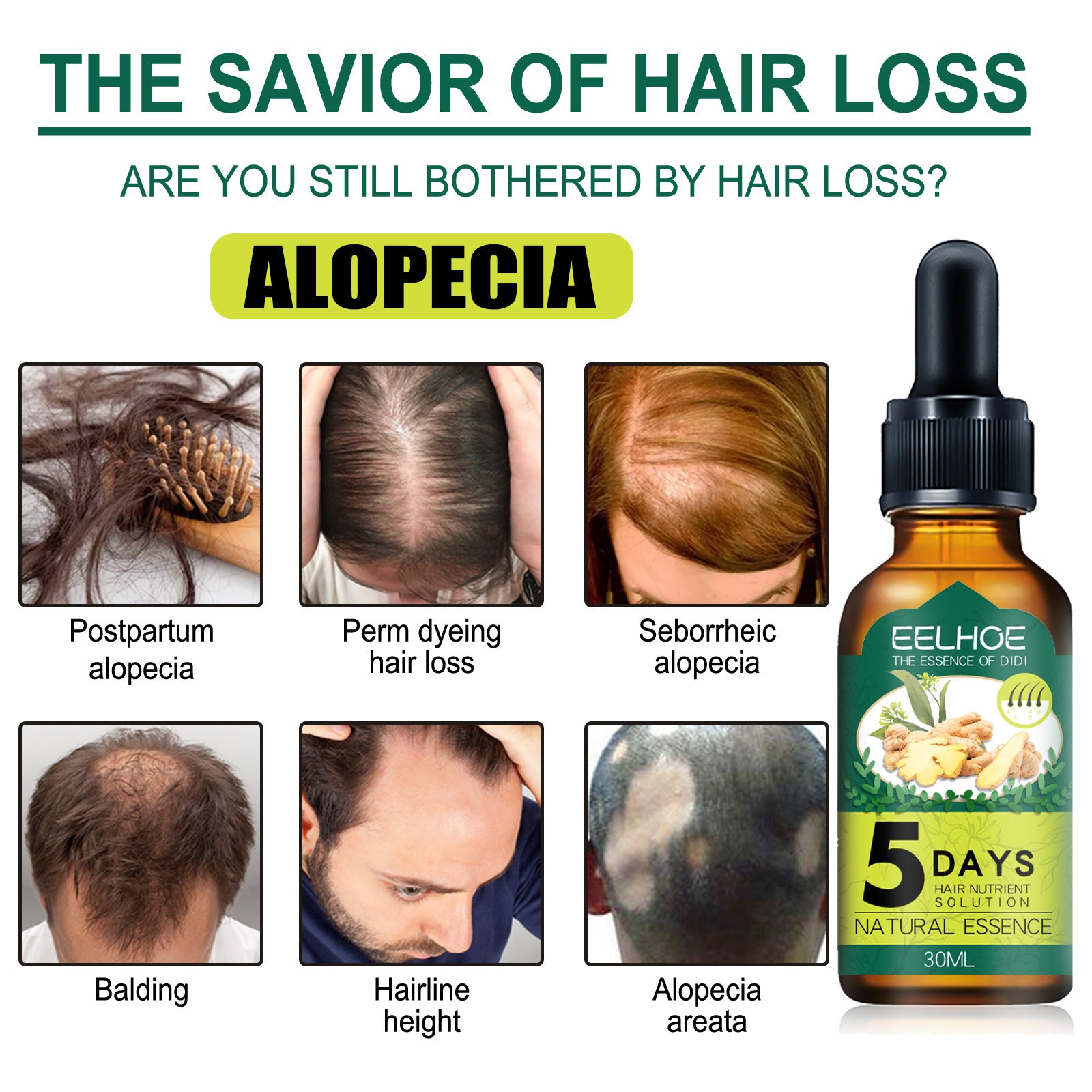 Eelhoe Ginger Hair Essential Oil. Eelhoe Ginger Hair Essential Oil - Your Shopify