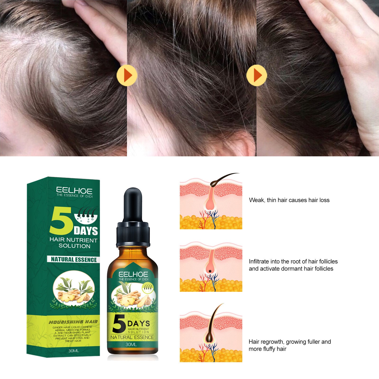 Eelhoe Ginger Hair Essential Oil. Eelhoe Ginger Hair Essential Oil - Your Shopify