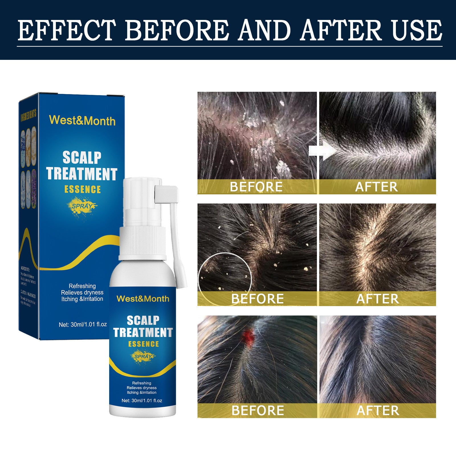 Hair Care Hair Follicle Damage Hair Root Care Spray - Your Shopify