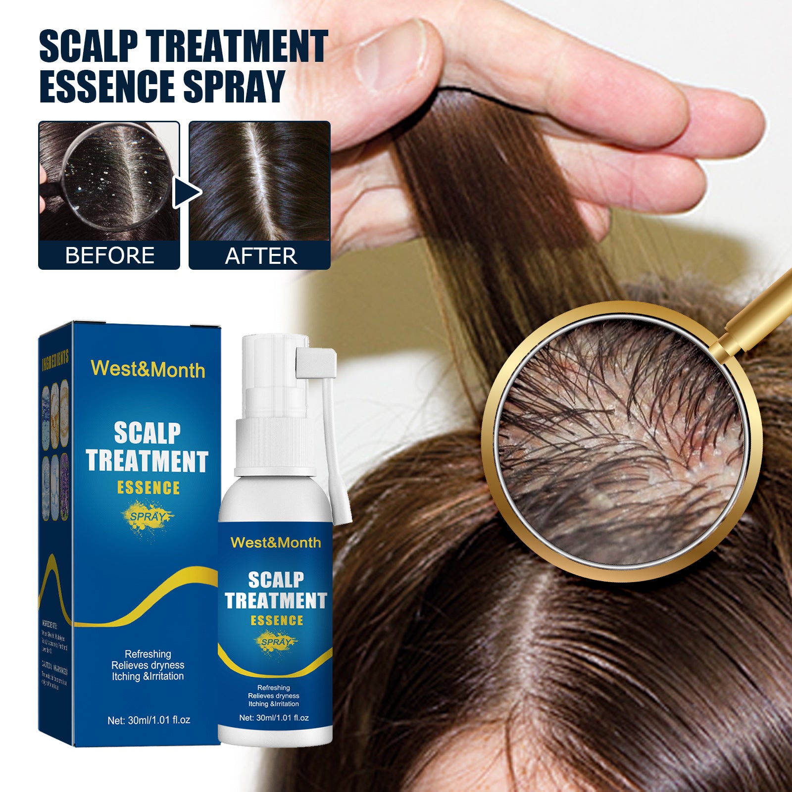 Hair Care Hair Follicle Damage Hair Root Care Spray - Your Shopify