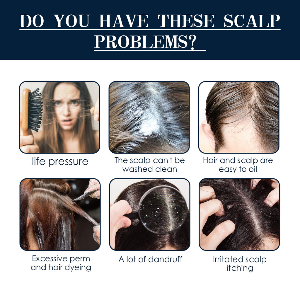 Hair Care Hair Follicle Damage Hair Root Care Spray - Your Shopify